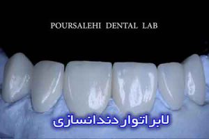 لابراتوار دندانسازی تهران
